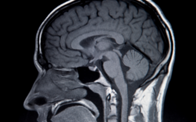 Why Do People With Dementia Repeat Themselves?